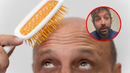 ¿Puede la masturbación causar calvicie? La ciencia responde a este mito