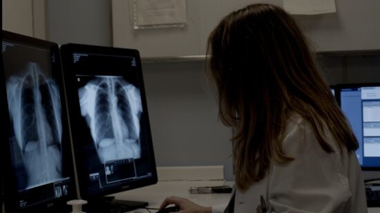 Los pacientes de Osakidetza ya pueden descargar desde casa las imágenes de sus radiografías o resonancias