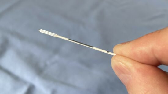 Doctor Zumalacárregui: “Eliminamos varices sin cirugía gracias a una fibra ultrafina”