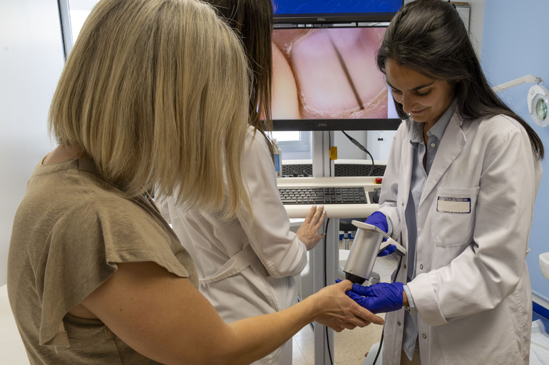 Osakidetza alerta sobre el melanoma acral en manos, pies y uñas: la autoexploración puede salvar vidas