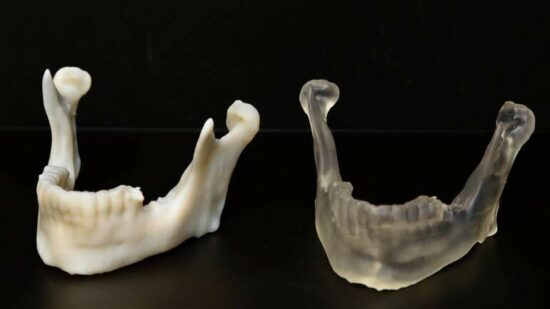 Osakidetza apuesta por la impresión 3D para mejorar la atención a los pacientes