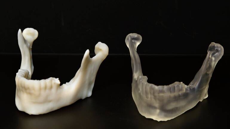 Osakidetza apuesta por la impresión 3D para mejorar la atención a los pacientes
