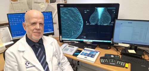 Osakidetza convierte las mamografías en una herramienta para detectar el riesgo cardiovascular en mujeres